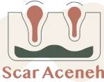 اسکار آکنه