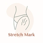 استرچ مارک